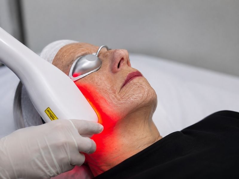 Lumina Lift HIFU NEOSENSE Lima