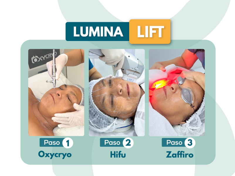 Lumina Lift